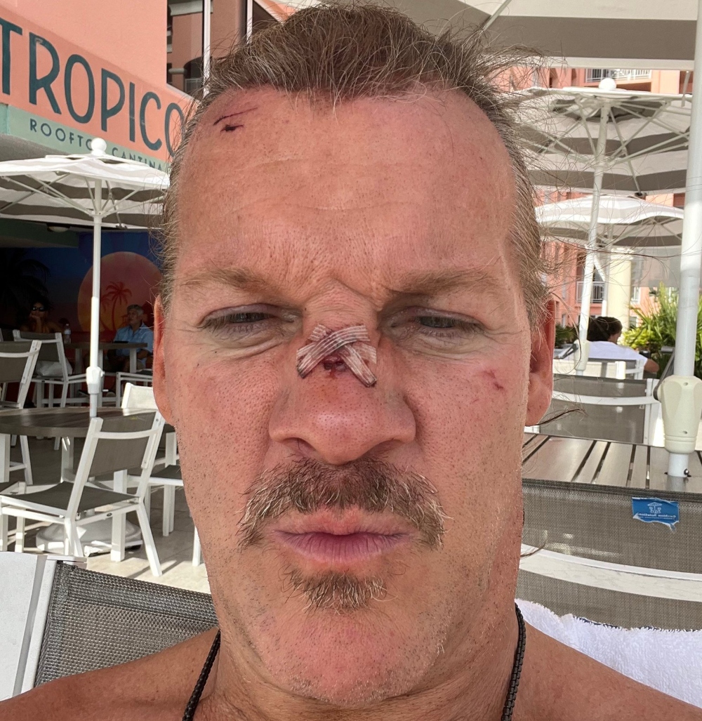 AEW’s Chris Jericho suffers broken nose in barbed wire death match