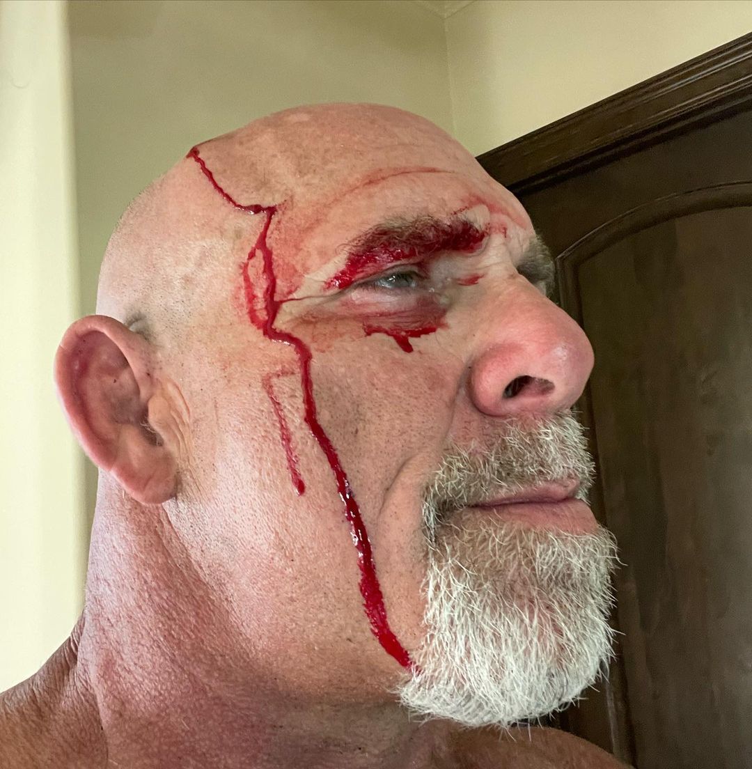 Goldberg suffers bloody head wound in farm accident
