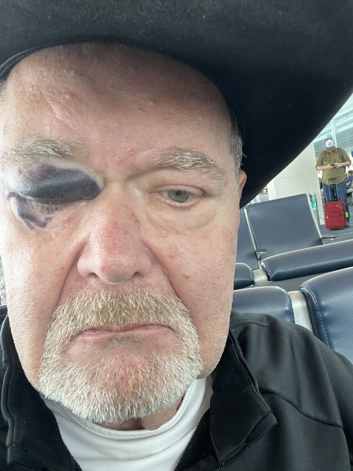 Jim Ross suffers black eye in fall, still set for AEW Collision