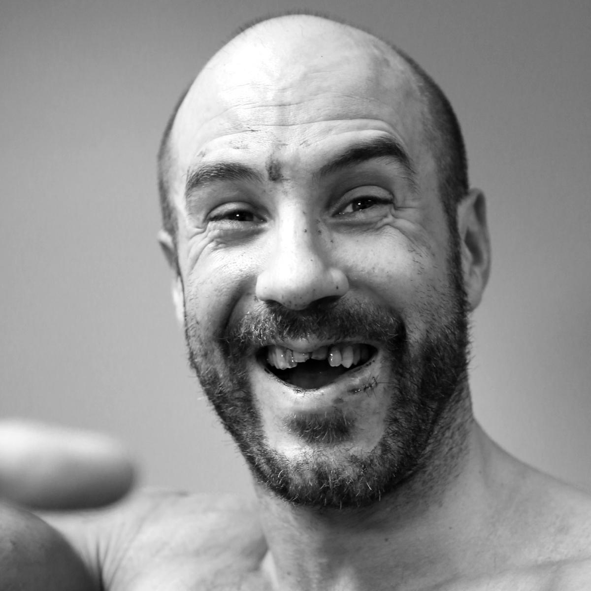 Cesaro visiting dental surgeon, expected back this week