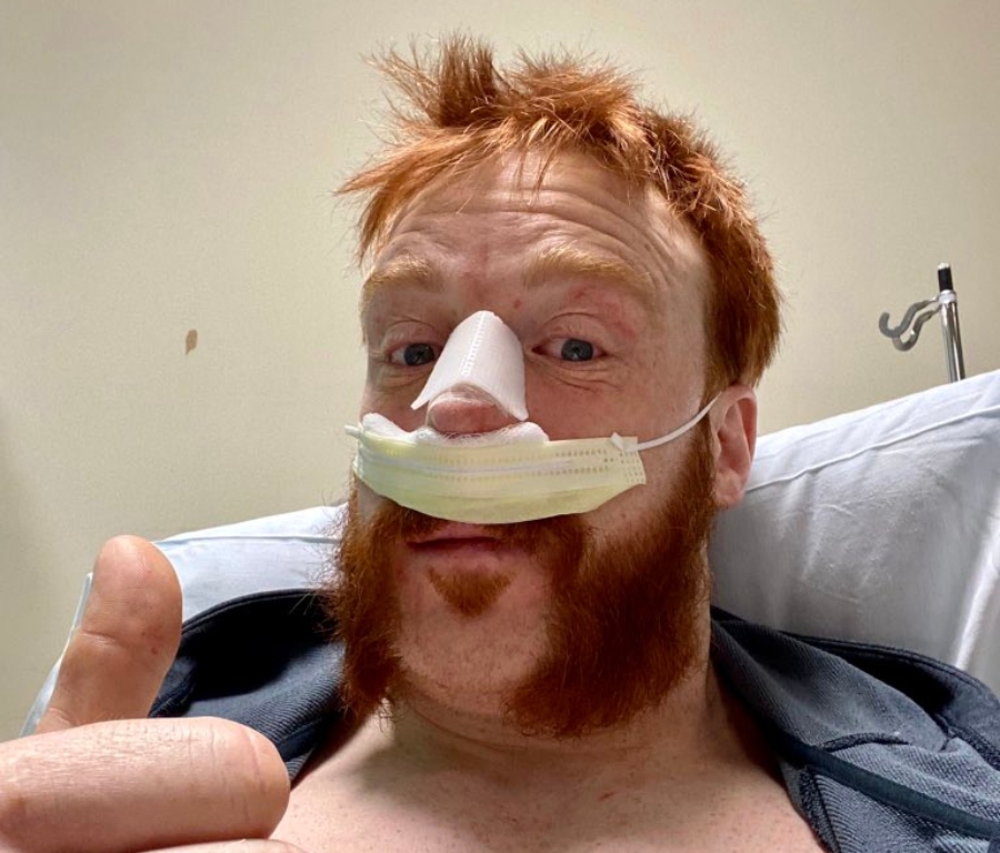 WWE’s Sheamus undergoes second surgery for broken nose