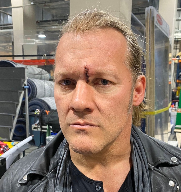 Chris Jericho gets seven stitches following AEW Dynamite brawl