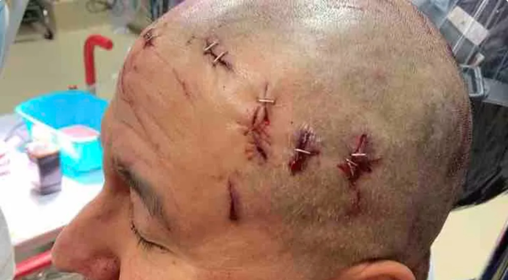 Referee recovering from multiple head wounds inflicted by wrestler