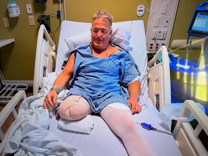 Former WCW wrestler Buff Bagwell undergoes leg amputation